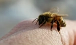 Apitelapije ili liječenje bile bees