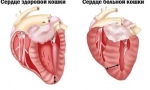 Što je hipertrofična kardiomiopatija u mački i šta je opasno