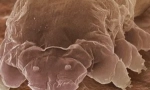 Mite demodex i karakteristike njegovih sredstava za život