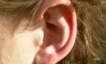 Kolloza i uši ući u ljudima