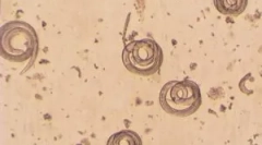 Šta je trihinella spiralis