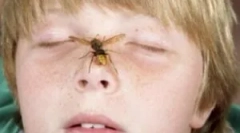 Akcije roditelja, ako beba bile wasp