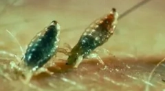 Kako izgledaju uši uzici?