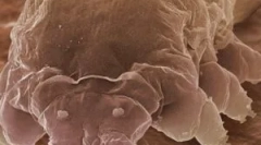 Mite demodex i karakteristike njegovih sredstava za život