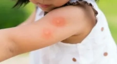 Najbolji alati od komaraca za djecu