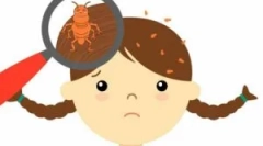 Mjere prevencije pedikulacije