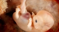 Ontogeneza i svojstvene obrasce