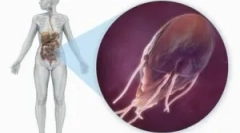 Snaga i prehrana sa giardiasis