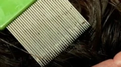 Postupak završetka za uši i nd