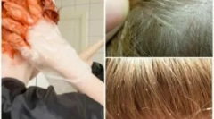 Ubi li lice za kosu za kosu?