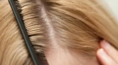 Vrsta ušiju kod ljudi