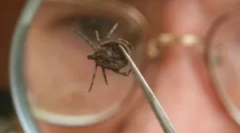 Man infekcija sa krpeljnim encefalitisom